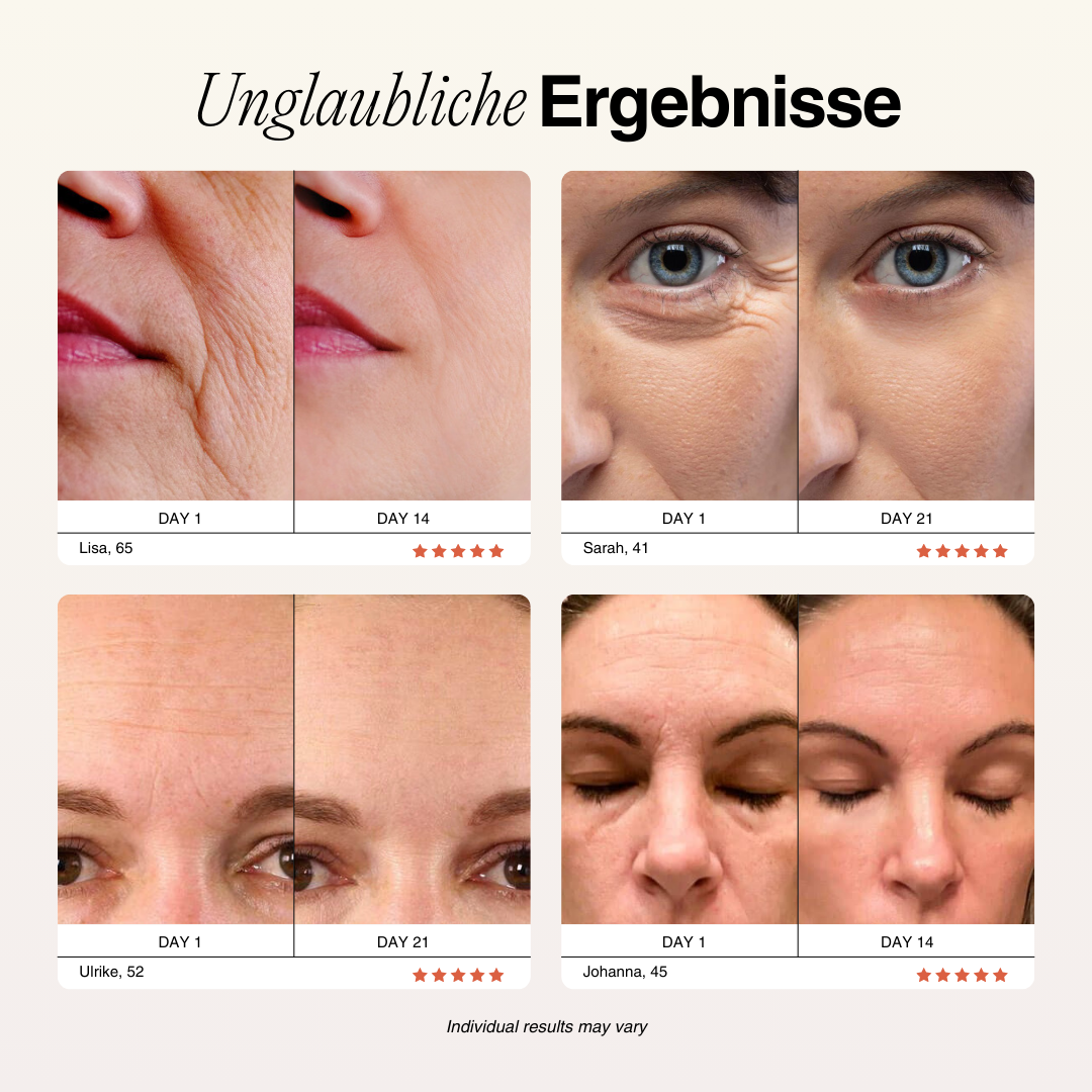 Dr. Severin One Pro 4-in-1 (+ 4 sueros gratis)