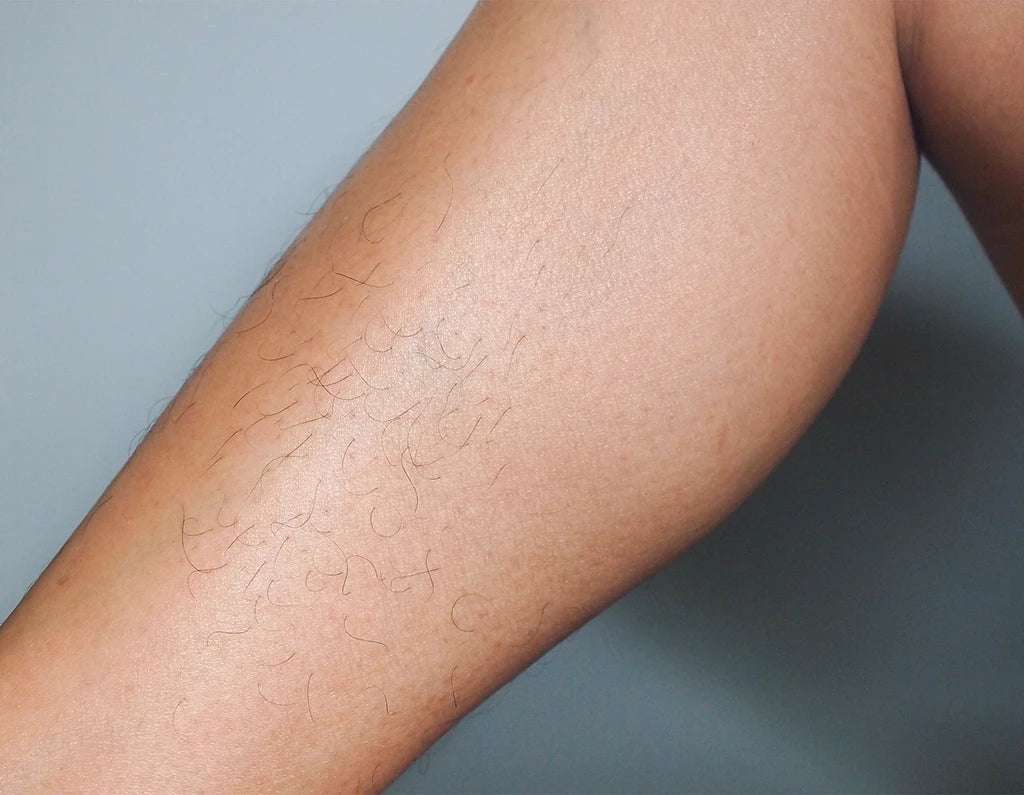 Bein mit glatter Haut zeigt die gründliche Wirkung des Dr. Severin Sugarings